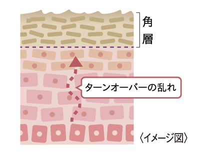 図1