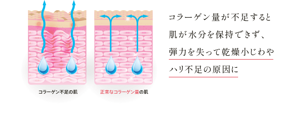 コラーゲン量が不足すると肌が水分を保持できず、 弾力を失って 乾燥小じわやハリ不足の原因に