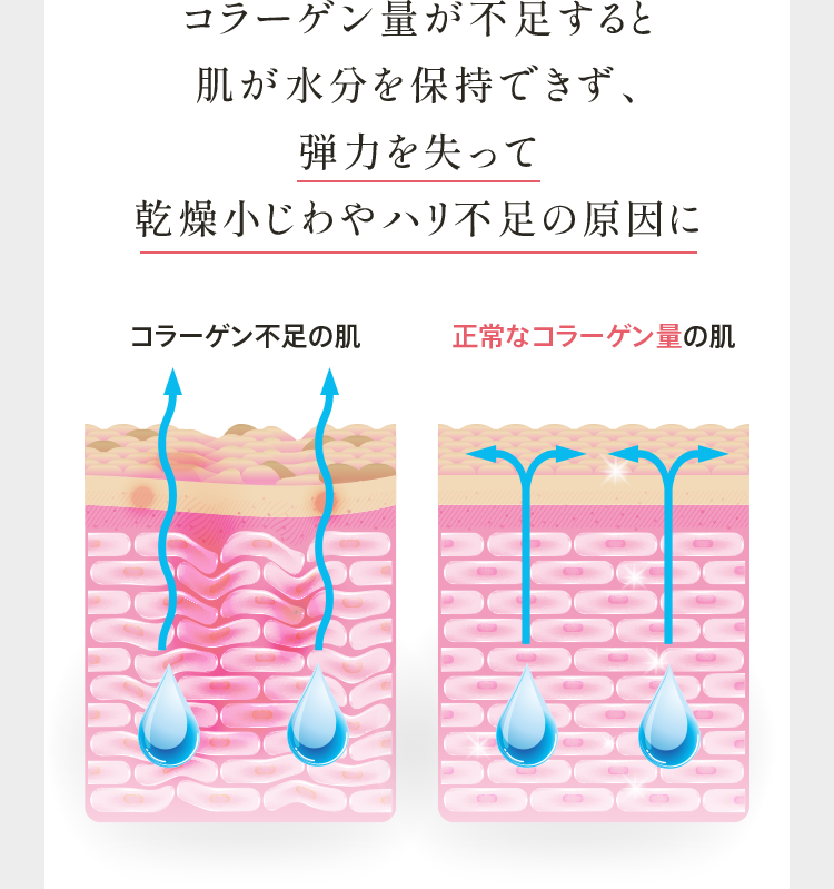 コラーゲン量が不足すると肌が水分を保持できず、 弾力を失って 乾燥小じわやハリ不足の原因に
